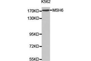 Western Blotting (WB) image for anti-MutS Homolog 6 (E. Coli) (MSH6) antibody (ABIN1873754) (MSH6 抗体)