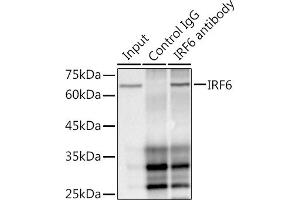 Immunoprecipitation analysis of 300 μg extracts of HepG2 cells using 3 μg IRF6 antibody (ABIN1680921, ABIN3017588, ABIN3017589 and ABIN7101507). (IRF6 抗体)