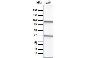 Western Blot Analysis of Raji cell lysate using CD20 Mouse Monoclonal Antibody (L26). (CD20 抗体)