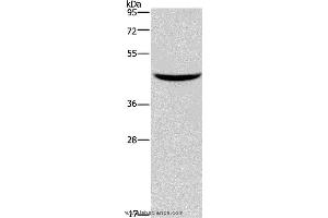 Western blot analysis of Mouse pancreas tissue, using GIPR Polyclonal Antibody at dilution of 1:150 (GIPR 抗体)