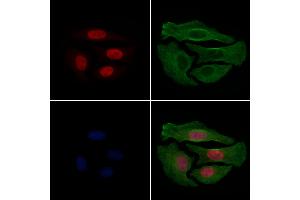 ABIN6256332 and ABIN6267233 staining Hela cells(4h of LPS treatment) by IF/ICC. (HDAC3 抗体  (pSer424))
