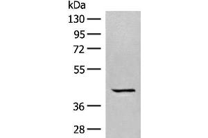 Western blot analysis of A549 cell lysate using GPR62 Polyclonal Antibody at dilution of 1:350 (GPR62 抗体)