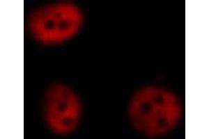 ABIN6267428 staining HeLa cells treated with EGF 200nM 5' by ICC/IF.