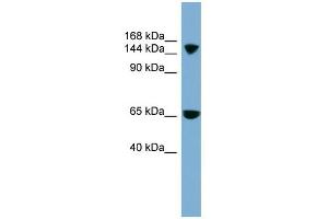 SLC4A5 antibody used at 1 ug/ml to detect target protein. (NBC4 抗体  (Middle Region))