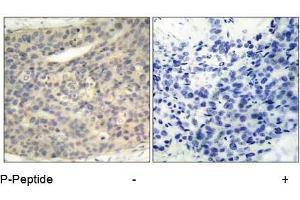 Image no. 1 for anti-LIM Domain Kinase 1 (LIMK1) (pThr508) antibody (ABIN196830) (LIM Domain Kinase 1 抗体  (pThr508))