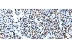 Immunohistochemistry of paraffin-embedded Human tonsil tissue using USP37 Polyclonal Antibody at dilution of 1:45(x200) (USP37 抗体)