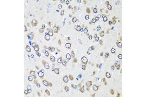 Immunohistochemistry of paraffin-embedded rat brain using EEF1G antibody at dilution of 1:100 (40x lens). (EEF1G 抗体)