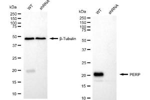 anti-TP53 Apoptosis Effector (PERP) antibody
