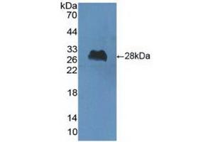 Detection of Recombinant ChAT, Human using Polyclonal Antibody to Choline Acetyltransferase (ChAT) (Choline Acetyltransferase 抗体  (AA 517-732))