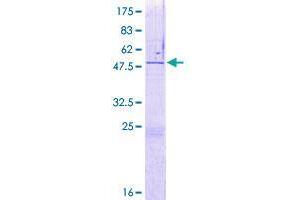 ZNF771 Protein (AA 1-275) (GST tag)