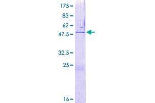 ZNF771 Protein (AA 1-275) (GST tag)