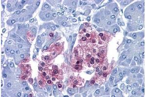 Immunohistochemistry (Formalin-fixed Paraffin-embedded Sections) (IHC (fp)) image for anti-Secretagogin, EF-Hand Calcium Binding Protein (SCGN) (AA 1-277) antibody (ABIN574421)