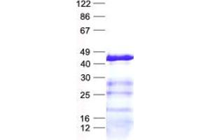 DHRS13 Protein (His tag)