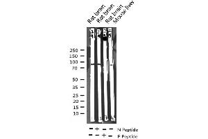 Western blot analysis of Phospho-ADAM 17 (Thr735) expression in various lysates (ADAM17 抗体  (pThr735))