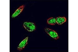 Confocal immunofluorescent analysis of c-Src antibody with A375 cells followed by Alexa Fluor 488-conjugated goat anti-rabbit lgG (green). (Src 抗体  (AA 1-30))