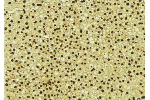 ABIN6276714 at 1/100 staining Mouse liver tissue by IHC-P. (ANG 抗体  (Internal Region))
