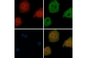 ABIN6265187 and ABIN6272863 staining Hela cells by IF/ICC.