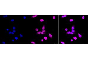 Immunocytochemical staining of HAP-1 cells with PCBP1 antibody (ABIN7800958), 1:1,000). (Recombinant Poly Binding Protein 1 抗体)