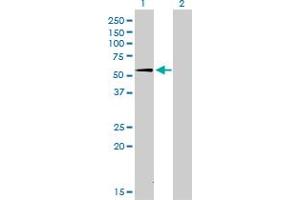 Western Blot analysis of SUOX expression in transfected 293T cell line by SUOX monoclonal antibody (M01), clone 1H1. (SUOX 抗体  (AA 1-488))