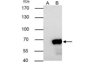 IP Image Nucleoporin p62 antibody immunoprecipitates NUP62 protein in IP experiments. (NUP62 抗体)