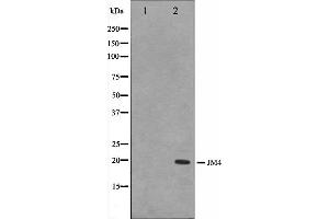 Western blot analysis on LOVO cell lysate using JM4 Antibody. (PRAF2 抗体  (C-Term))