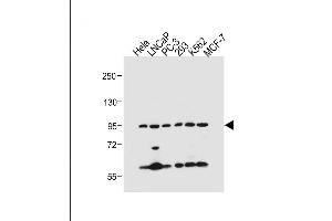 All lanes : Anti-PKN beta Antibody (C-term) at 1:500 dilution Lane 1: Hela whole cell lysate Lane 2: LNCaP whole cell lysate Lane 3: PC-3 whole cell lysate Lane 4: 293 whole cell lysate Lane 5: K562 whole cell lysate Lane 6: MCF-7 whole cell lysate Lysates/proteins at 20 μg per lane. (PKN beta 抗体  (C-Term))