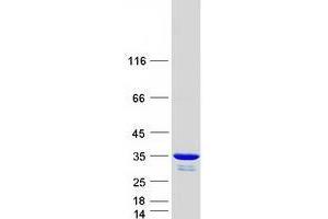 Western Blotting (WB) image for Uridine-Cytidine Kinase 2 (UCK2) protein (Myc-DYKDDDDK Tag) (ABIN2734967)