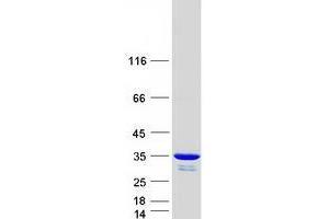 Validation with Western Blot (UCK2 Protein (Myc-DYKDDDDK Tag))