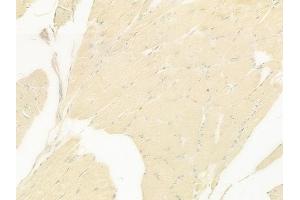 ABIN6259832 and ABIN6279098 at 1/100 staining human tongue carcinoma by IHC-P. (AGXT2 抗体  (Internal Region))