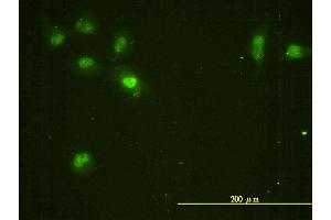 Immunofluorescence of monoclonal antibody to CDC2L5 on HeLa cell. (CDK13 抗体  (AA 1-324))