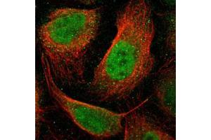 Immunofluorescent staining of U-2 OS with RARB polyclonal antibody  (Green) shows positivity in nucleus but excluded from the nucleoli.