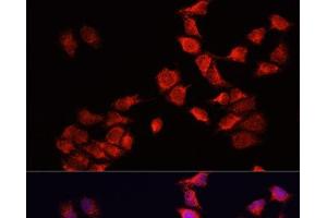 Immunofluorescence analysis of HeLa cells using BNIP3 Polyclonal Antibody at dilution of 1:100. (BNIP3 抗体)