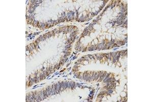 Immunohistochemistry (Paraffin-embedded Sections) (IHC (p)) image for anti-Tropomyosin-2 (TPM2) antibody (ABIN3017365)