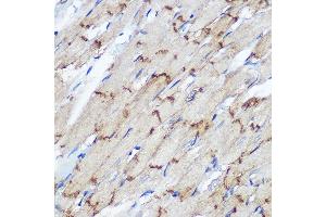 Immunohistochemistry of paraffin-embedded Rat heart using Connexin 43 Rabbit pAb (ABIN6131701, ABIN6141098, ABIN6141099 and ABIN6215448) at dilution of 1:100 (40x lens). (Connexin 43/GJA1 抗体  (AA 233-382))