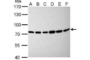 WB Image Moesin antibody [C2C3], C-term detects MSN protein by Western blot analysis. (Moesin 抗体  (C-Term))