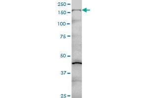 COL5A1 monoclonal antibody (M01), clone 2F4 Western Blot analysis of COL5A1 expression in Hela S3 NE . (COL5A1 抗体  (AA 1-591))
