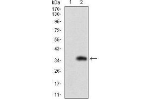 Western Blotting (WB) image for anti-Solute Carrier Family 27 (Fatty Acid Transporter), Member 2 (SLC27A2) (AA 346-405) antibody (ABIN1724864)