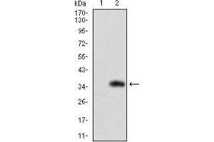 Western blot analysis using SLC27A2 mAb against HEK293 (1) and SLC27A2 (AA: 346-405)-hIgGFc transfected HEK293 (2) cell lysate. (SLC27A2 抗体  (AA 346-405))
