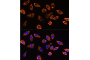 Immunofluorescence analysis of L929 cells using GNB1 Rabbit pAb (ABIN6129389, ABIN6141219, ABIN6141220 and ABIN6219000) at dilution of 1:100 (40x lens).