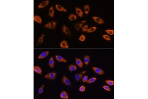 Immunofluorescence analysis of L929 cells using GNB1 Rabbit pAb (ABIN6129389, ABIN6141219, ABIN6141220 and ABIN6219000) at dilution of 1:100 (40x lens). (GNB1 抗体  (AA 1-340))