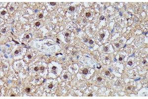 Immunohistochemistry of paraffin-embedded Mouse liver using IGHMBP2 Polyclonal Antibody at dilution of 1:100 (40x lens). (IGHMBP2 抗体)