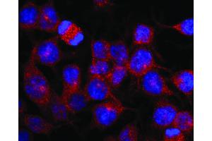 Immunofluorescence staining of vesicles (red) in RBL-2H3 rat basophilic leukemia cell line using anti-Kinesin (KN-03). (Kinesin (heavy chain) 抗体)