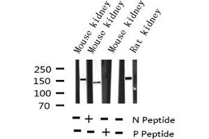 Western blot analysis of Phospho-VEGFR2 (Tyr951) expression in various lysates (VEGFR2/CD309 抗体  (pTyr951))