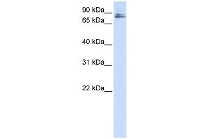 WB Suggested Anti-TMCO3 Antibody Titration:  0. (TMCO3 抗体  (N-Term))