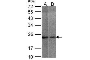 WB Image Sample(30 μg of whole cell lysate) A:A431, B:Hep G2, 12% SDS PAGE antibody diluted at 1:200 (NCS1 抗体)