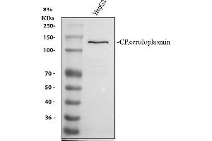 Western blot analysis of Ceruloplasmin using anti-Ceruloplasmin antibody (ABIN3044507). (Ceruloplasmin 抗体  (AA 20-259))