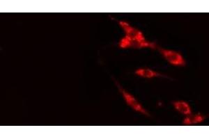 ABIN6275451 staining HeLa cells by IF/ICC. (G3BP2 抗体  (C-Term))