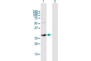 Western Blot analysis of SIRT5 expression in transfected 293T cell line by SIRT5 MaxPab polyclonal antibody. (SIRT5 抗体  (AA 1-310))