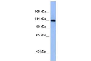 WB Suggested Anti-Tnik Antibody Titration: 1. (TNIK 抗体  (Middle Region))