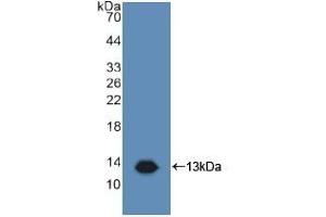 Detection of Recombinant TAPA1, Human using Polyclonal Antibody to Target Of The Antiproliferative Antibody 1 (TAPA1) (CD81 抗体  (AA 113-201))